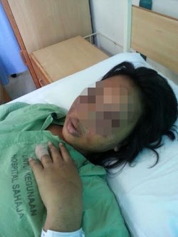 Majikan yang Aniaya TKI Asal NTB di Malaysia Dijerat Pasal Berlapis