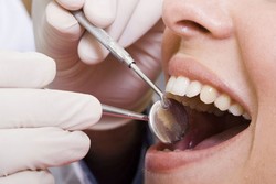 5 Makanan dan Minuman Enak Ini Ternyata Berpotensi Merusak Gigi