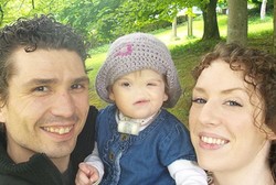 Terlahir Tanpa Hidung, Balita Ini Jalani Operasi Cangkok Hidung