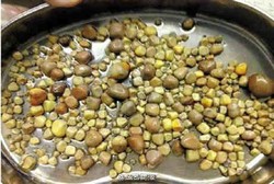 Ngeri! Ada 420 Batu Ginjal dalam Perut Pria Ini