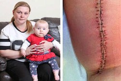 Kecelakaan Justru Selamatkan Ibu Ini dari Kanker Langka