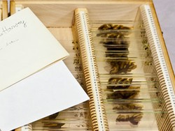 Siapa Sangka, Museum di AS Ini Simpan Otak Einstein