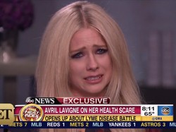 Curhat Soal Penyakit yang Diderita, Avril Lavigne Menangis