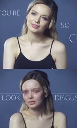 Kampanye Kecantikan, Blogger Ini Hapus Make-up dan Pamer Wajah Berjerawat