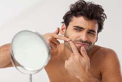 6 Cara Menutupi Bekas Jerawat Versi Dokter Kulit