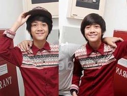 Alis Iqbaal CJR Sedikit Botak Pasca Kecelakaan