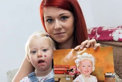 Foto Tanda Lahir Putrinya Diedit Tanpa Izin, Ibu Muda Ini Meradang