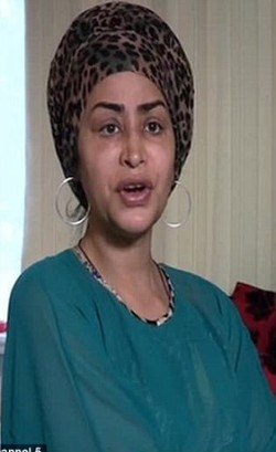 Dipaksa Suntik Filler, Mata Mantan Model Ini Malah Bengkak dan Luka