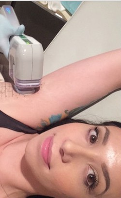 Perawatan Ketiak dengan Microwave untuk Hilangkan Bulu dan Bau Badan