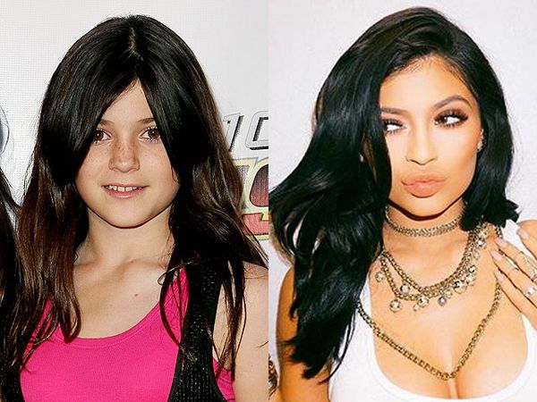 Lugu hingga Superseksi, Transformasi Kylie Jenner dari Tahun ke Tahun