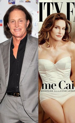 5 Selebriti yang Bangga Melakukan Operasi Plastik