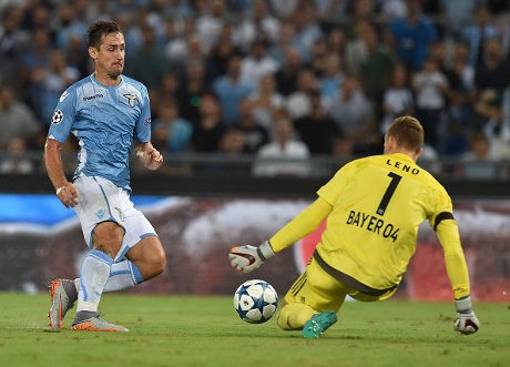 Cedera, Klose Pesimistis Bisa Tampil di Leg Kedua