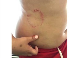 Turis Cilik Digigit Ikan Misterius di Pantai Spanyol