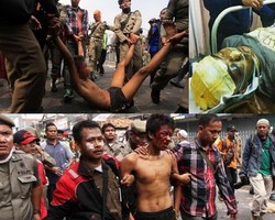 Eko Terbaring di RS Carolus, Kena Gebuk Satpol PP Saat Penggusuran Kp Pulo