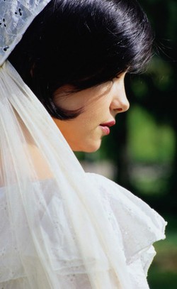 Malangnya Nasib Pengantin Ini yang Mengalami Kebotakan Jelang Pernikahan