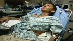 Selfie Bareng Ular, Pria Ini Terancam Diamputasi Selfie Bareng Ular, Pria Ini Terancam Diamputasi