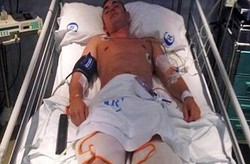 Terjun ke Kolam Dangkal di Spanyol, Turis Inggris Patah Punggung