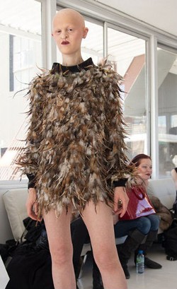 Melanie, Model Laris yang Tidak Punya Rambut dan Gigi