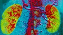 Uji Coba Ginjal Buatan ke Hewan Berhasil