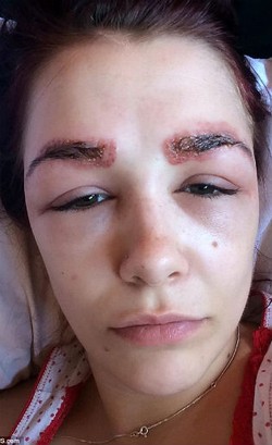 Kisah Wanita Gagal Perawatan Kecantikan: Alis Bernanah Hingga Payudara Ciut