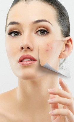 Ketika Menghilangkan Jerawat Tak Lagi Menyakitkan