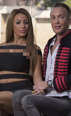 Obsesi Mirip Barbie & Ken, Pasangan Habiskan Rp 4 M untuk Operasi Plastik