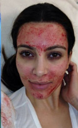 Perawatan Wajah Dari Masa ke Masa: Minum Darah Sendiri Hingga Facial Vampir