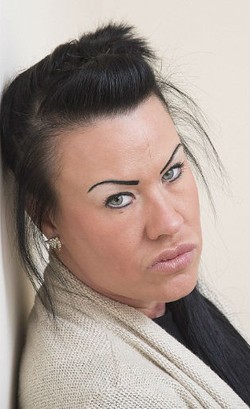 Ingin Seksi Hingga Kecanduan Botox, Bibir Wanita Ini Berlubang