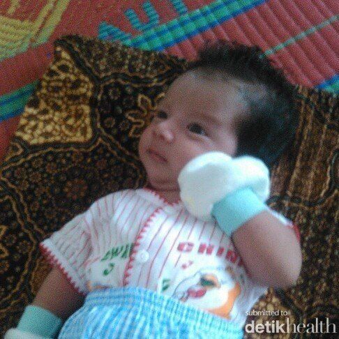 Kevin Alvaro Surbakti