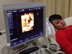 Wajah Cemas Donita Nantikan Kelahiran Anak Pertama