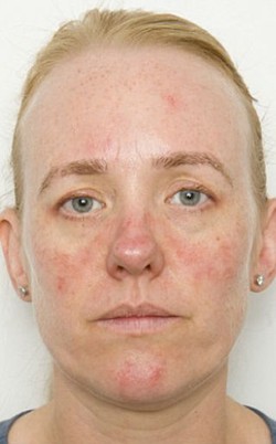 Seperti Ini Efeknya Jika Sebulan Tidur dengan Tetap Memakai Makeup