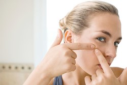 Agar Jerawat Tak Sering Muncul, Kurangi Konsumsi Makanan Pedas dan Keju (1)