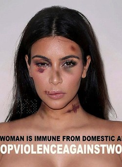 Saat Kim K Hingga Angelina Jolie Babak Belur untuk Kampanye Anti Kekerasan