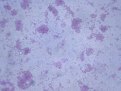 Bagaimana Bakteri E.Coli Masuk ke Dalam Makanan?