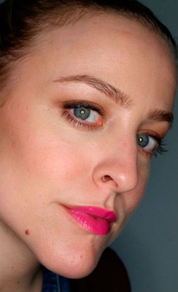 True Story: Wanita Ini Sembuh dari Jerawat Pasca Stop Konsumsi Susu