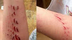 Bagaimana Rasanya Digigit Ikan Hiu Sepanjang 2 Meter?