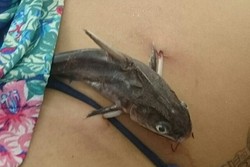 Asyik Berenang, 2 Turis Wanita Diserang Ikan Lele di Brasil