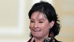 Pelaku Penyiraman Air Keras di Kolombia akan Dibui 12-50 Tahun