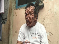 Mari Belajar dari Pak Urip yang Tak Kalah dengan Penyakit