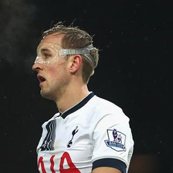 Buka Dulu Topengmu, Kane