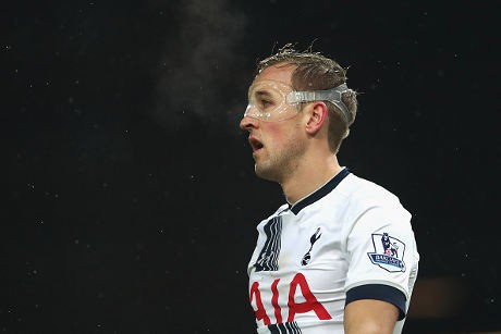 Buka Dulu Topengmu, Kane