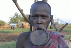 Di Ethiopia, Cantik Itu Sakit