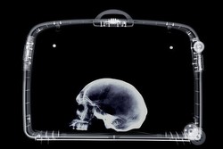 Bawa Tengkorak Manusia Dalam Koper, Seorang Profesor di Italia Ditahan