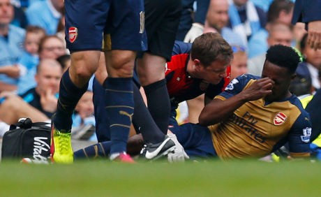 Welbeck Terancam Absen di Euro 2016