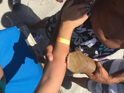 Cerita Traveler yang Tidak Bisa Lepas dari Gigitan Hiu Kecil