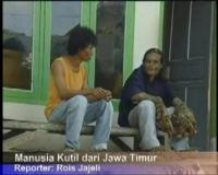 Manusia Kutil dari Jawa Timur