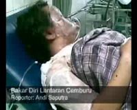 Bakar Diri Lantaran Cemburu