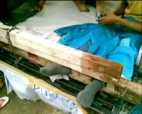 Pasung Kaki Menuntut BBM Turun