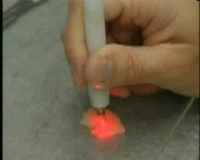 Teknologi Laser Sembuhkan Luka