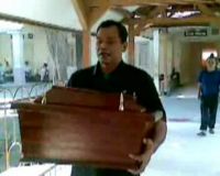 Kembar Siam Asal NTB Meninggal Dunia